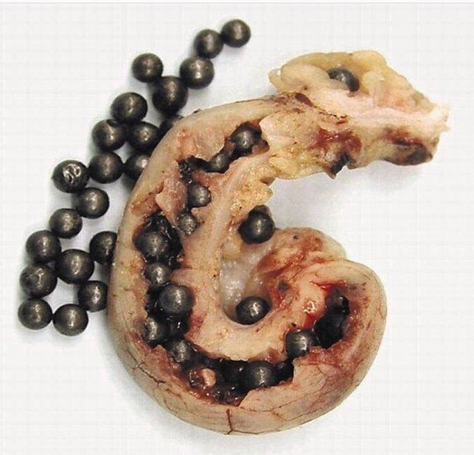 Pellets in the Appendix