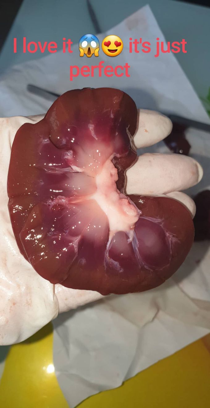 Veal kidney