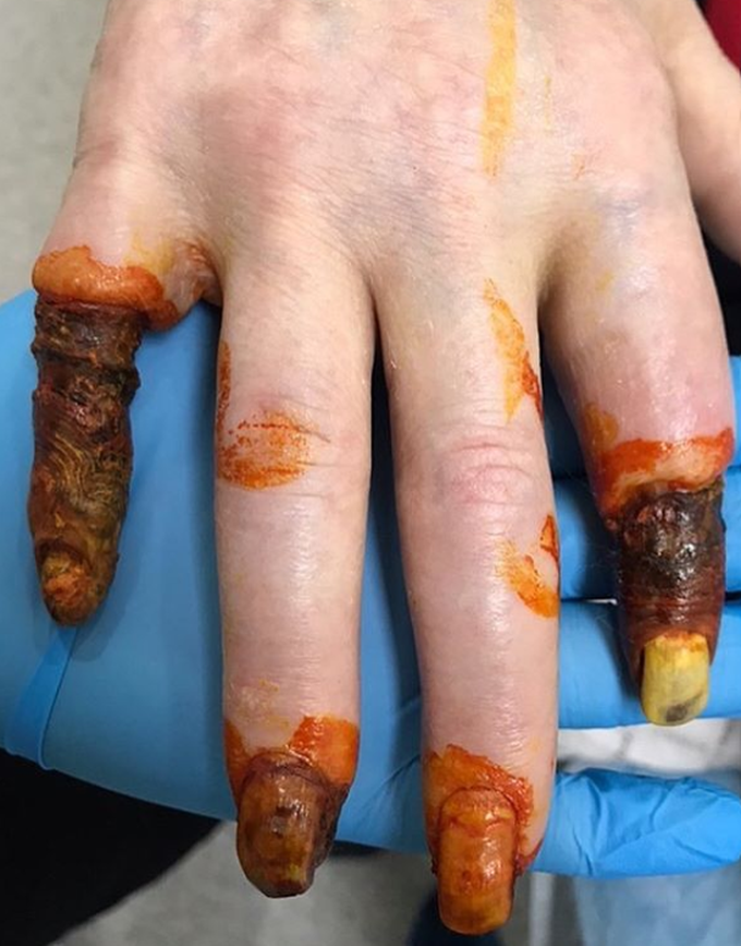 Diabetes… out of control!