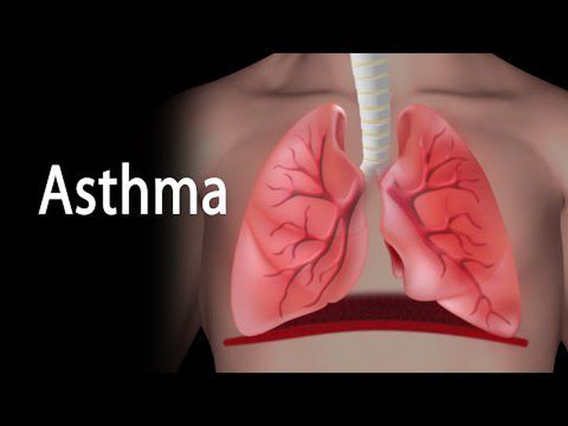 Tension pneumothorax - MEDizzy Tension pneumothorax - MEDizzy