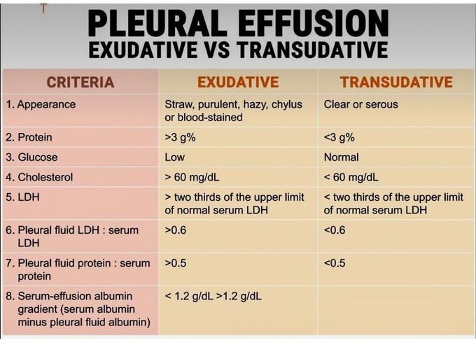 Pleural Effusion