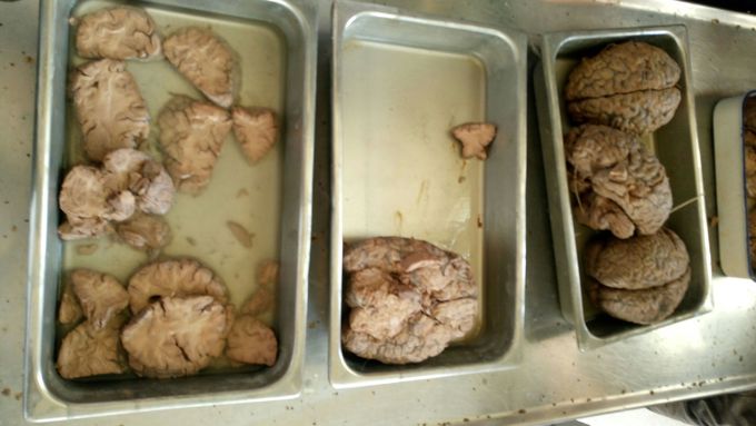 Beautiful brains