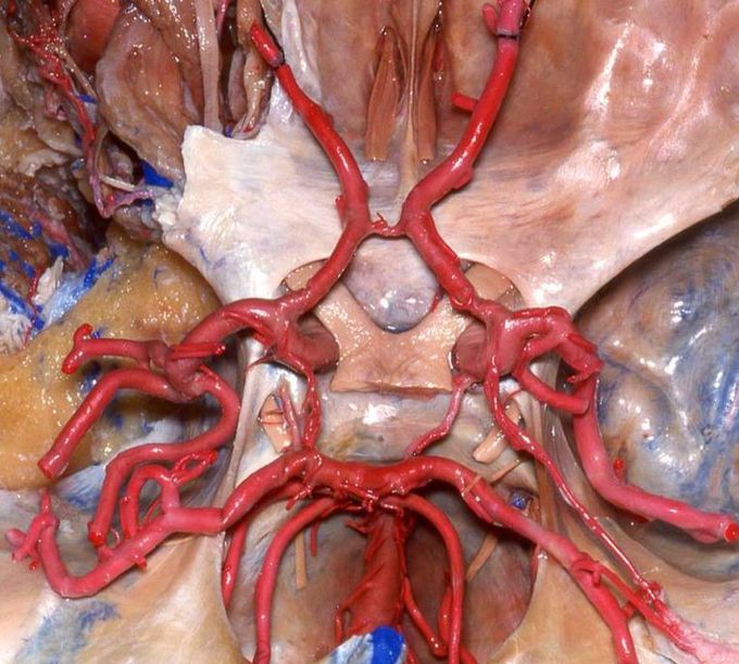 Circle of Willis