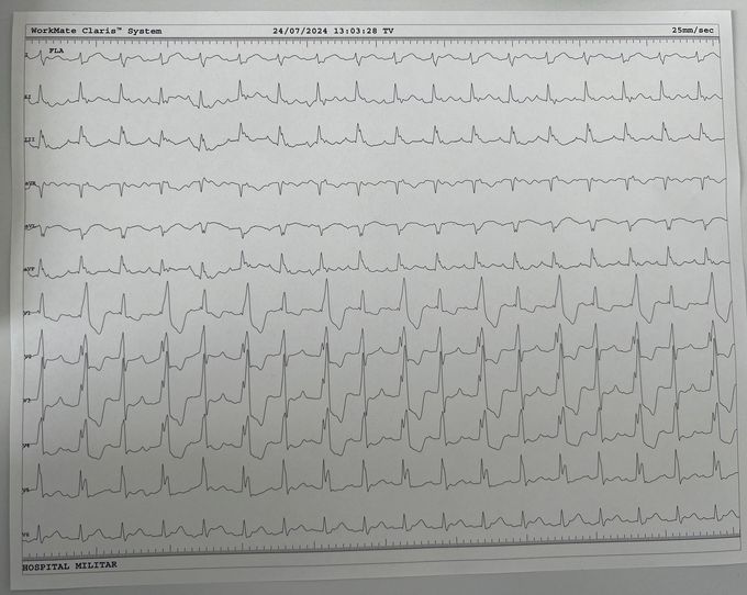 ECG of the day