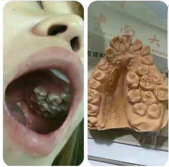 What is the name of this condition?