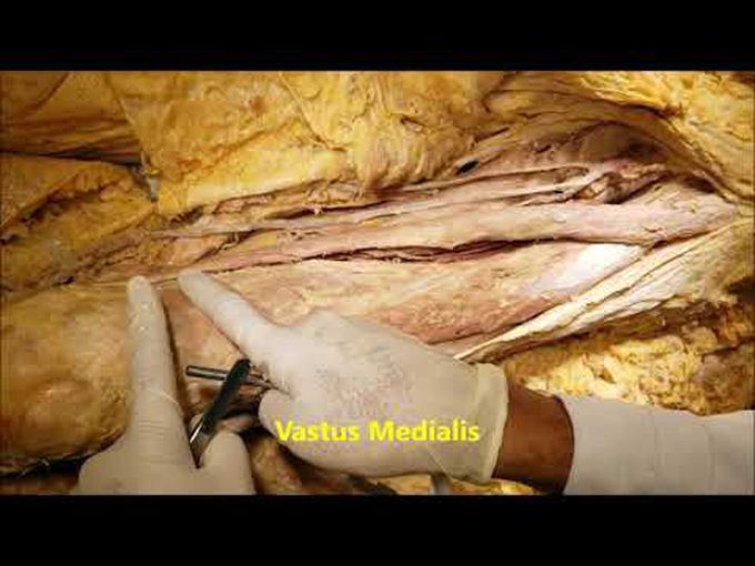 Dissection of the Anterior Compartment of the Thigh.