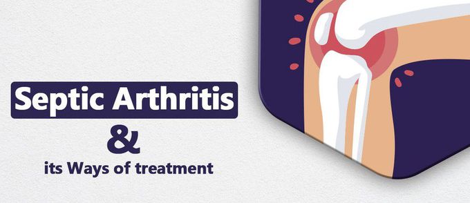 Treatment of septic arthritis
