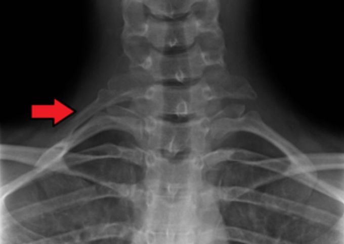 Diagnosis?