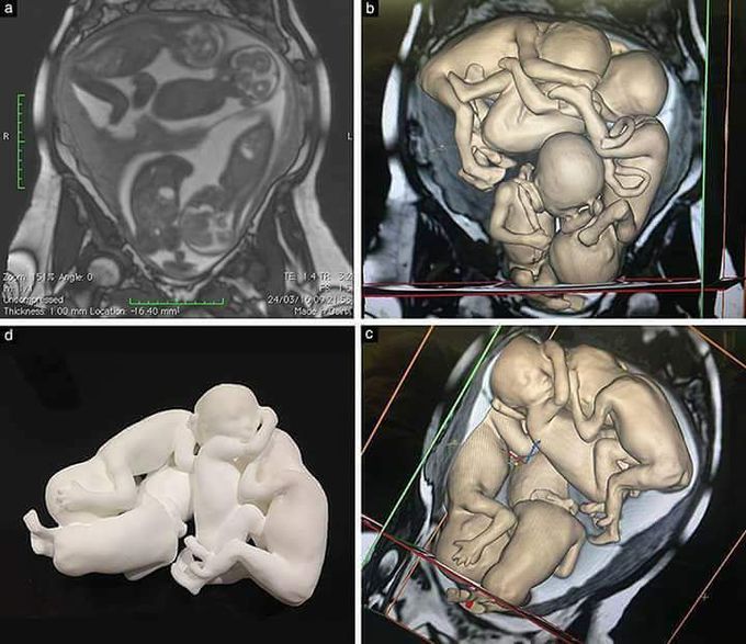 3D ultrasound and magnetic resonance imaging