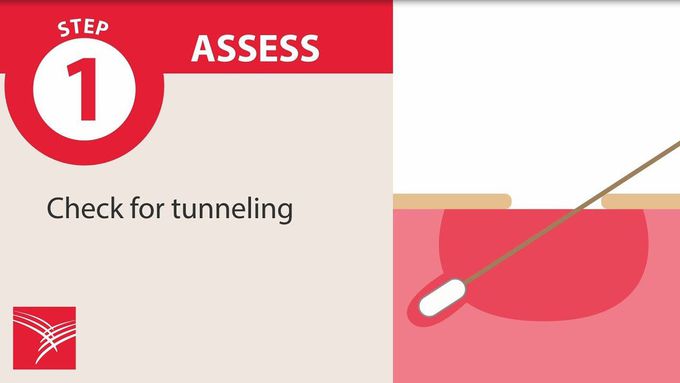 Wound Care in 7 Steps