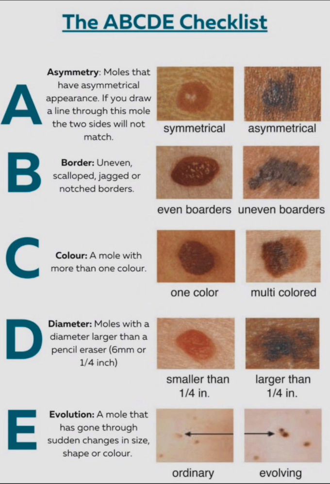 ABCDE Checklist