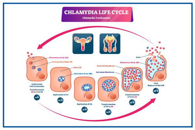 Chlamydia