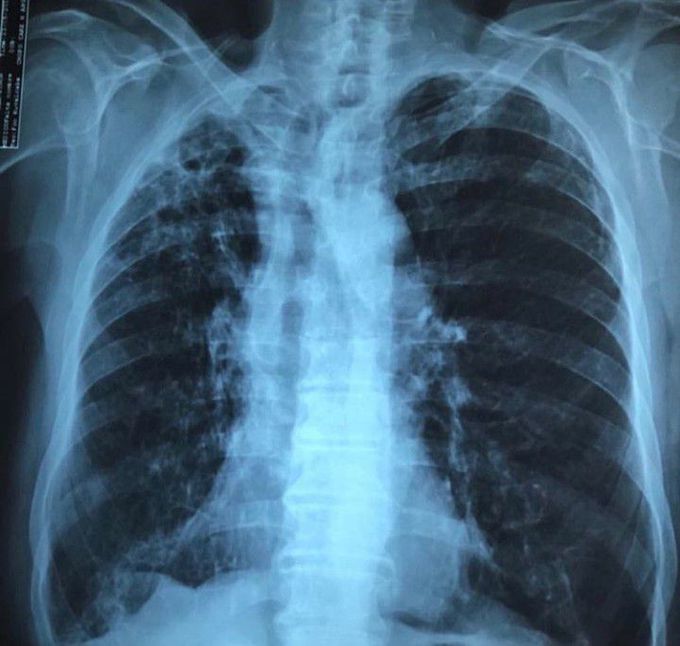 What's your diagnosis?