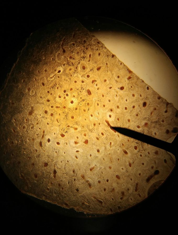 Transverse perforating (Volkmann) canals