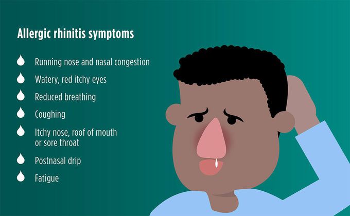 Allergic rhinitis