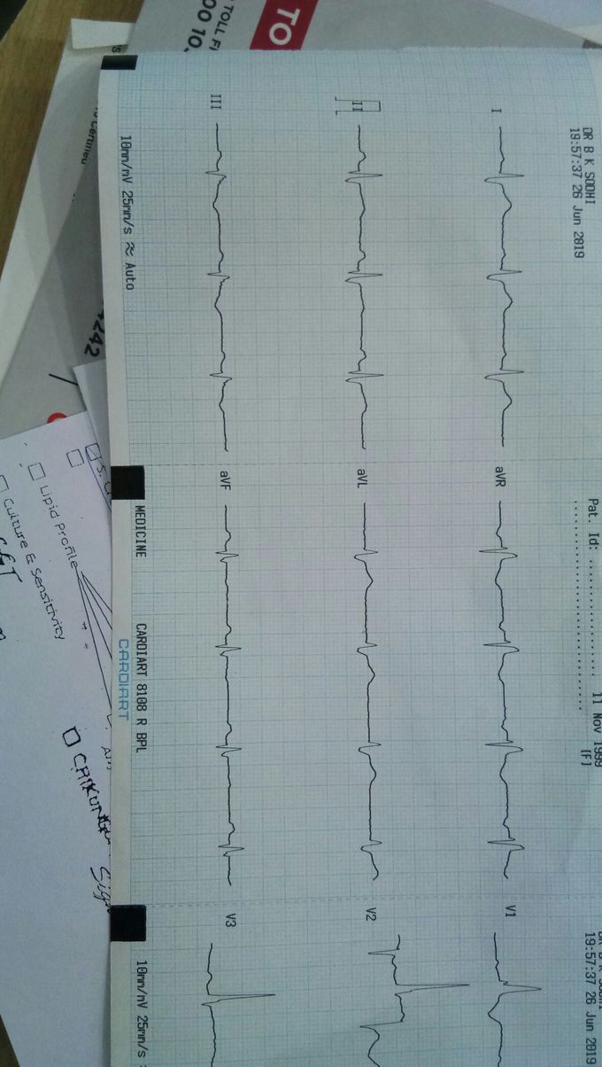 ECG diagnosis