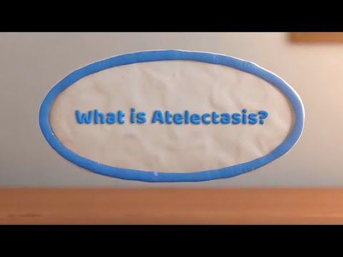 Quick review of Atelectasis