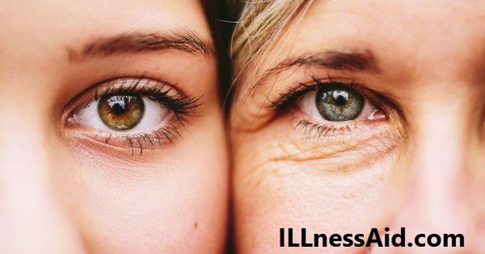 How To Slow Aging: Stay Young And Wrinkles Free - ILLnessAid