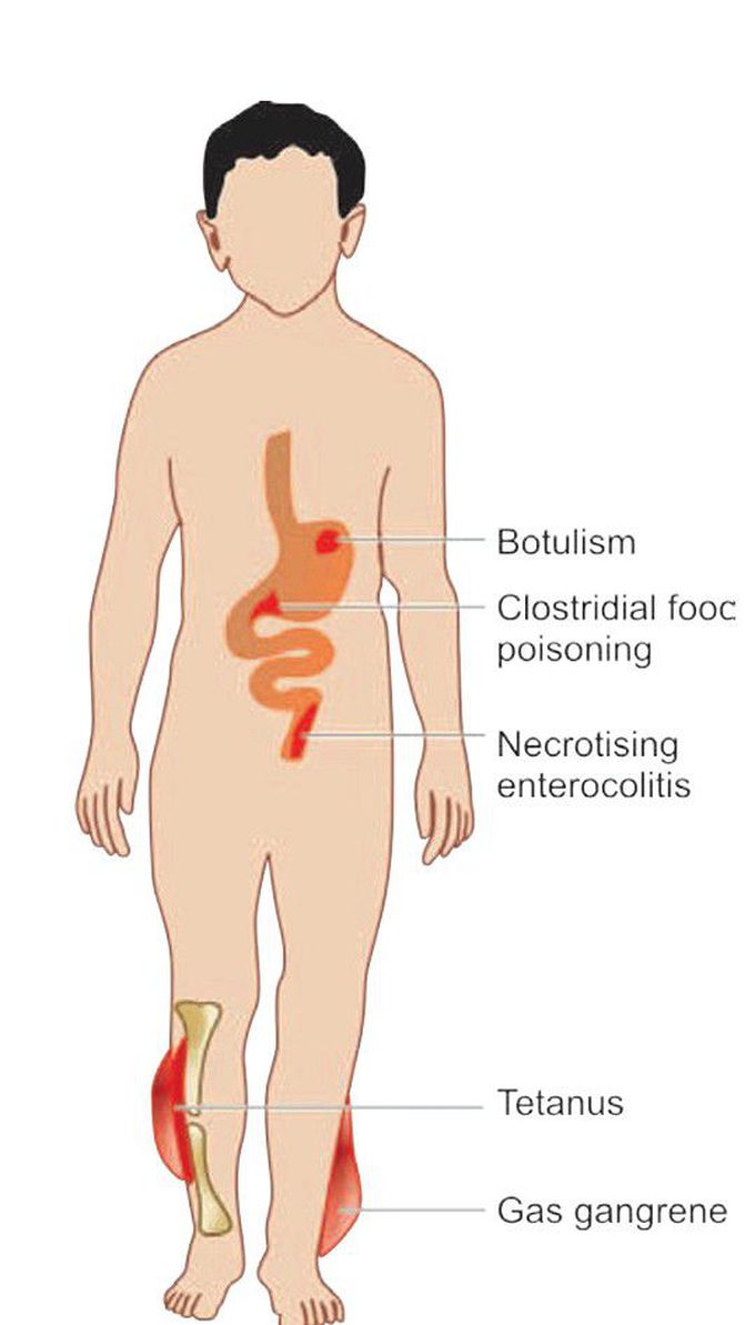 Clostridium species