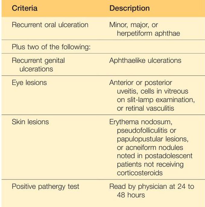 Behcet syndrome diagnosis