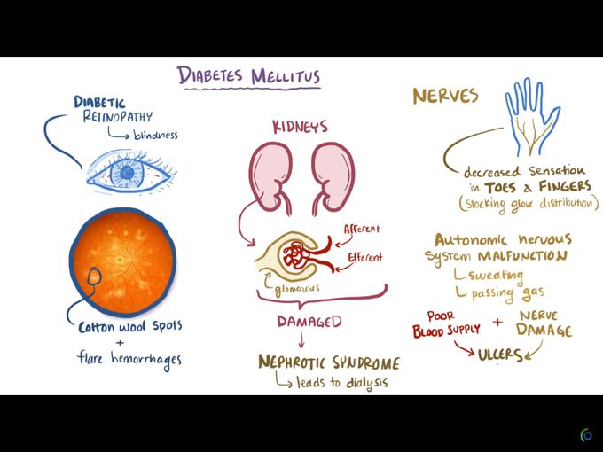 Diabetes complications