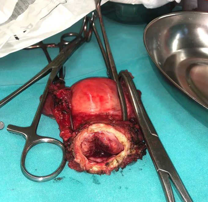 general surgery