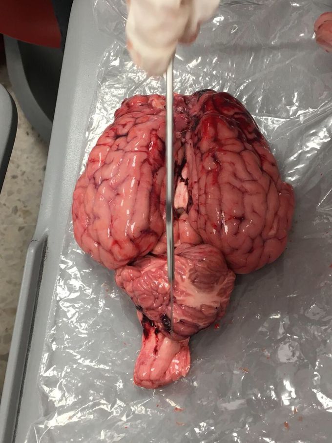 Brain