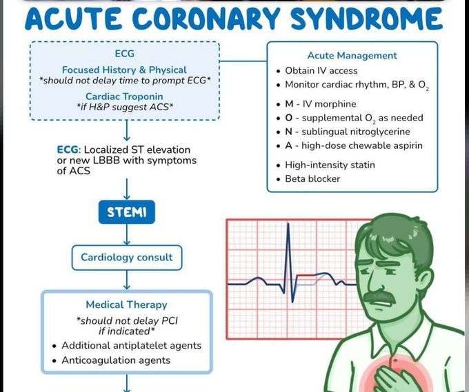 Acute Coronary Syndrome