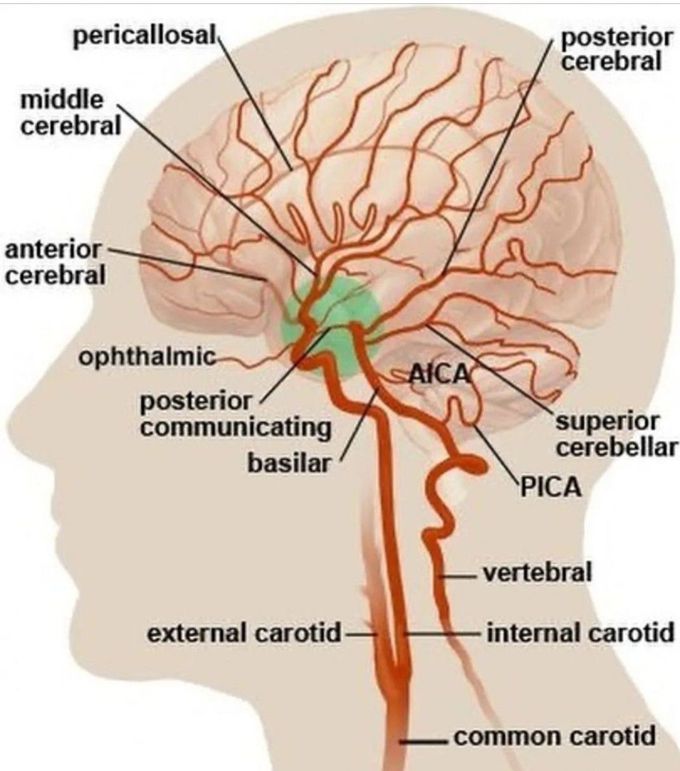 Circle of Willis