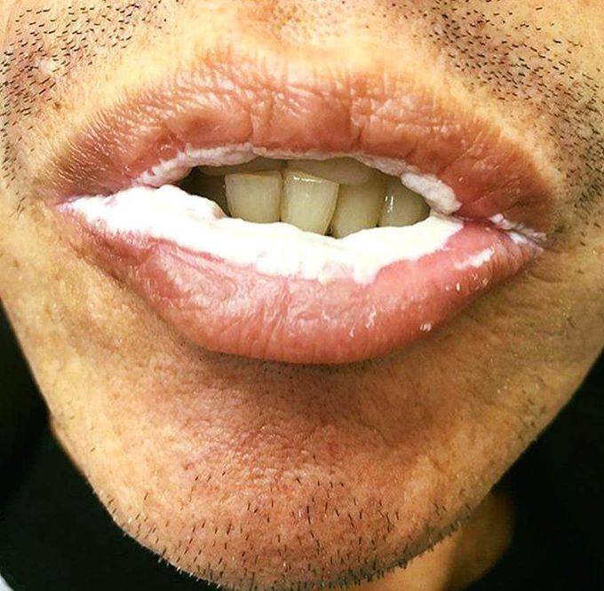 Q/diagnosis?