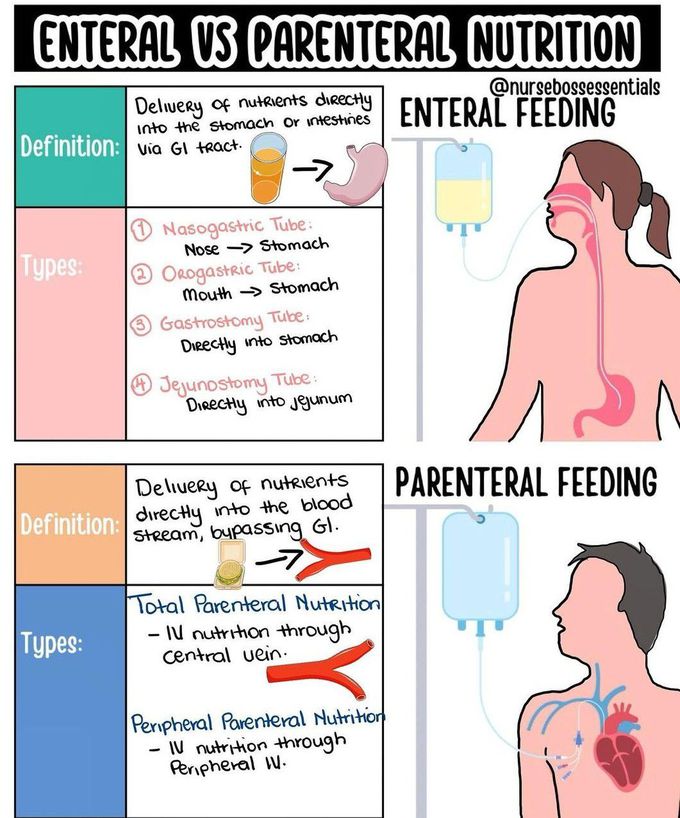 Enteral Vs Parenteral Nutrition