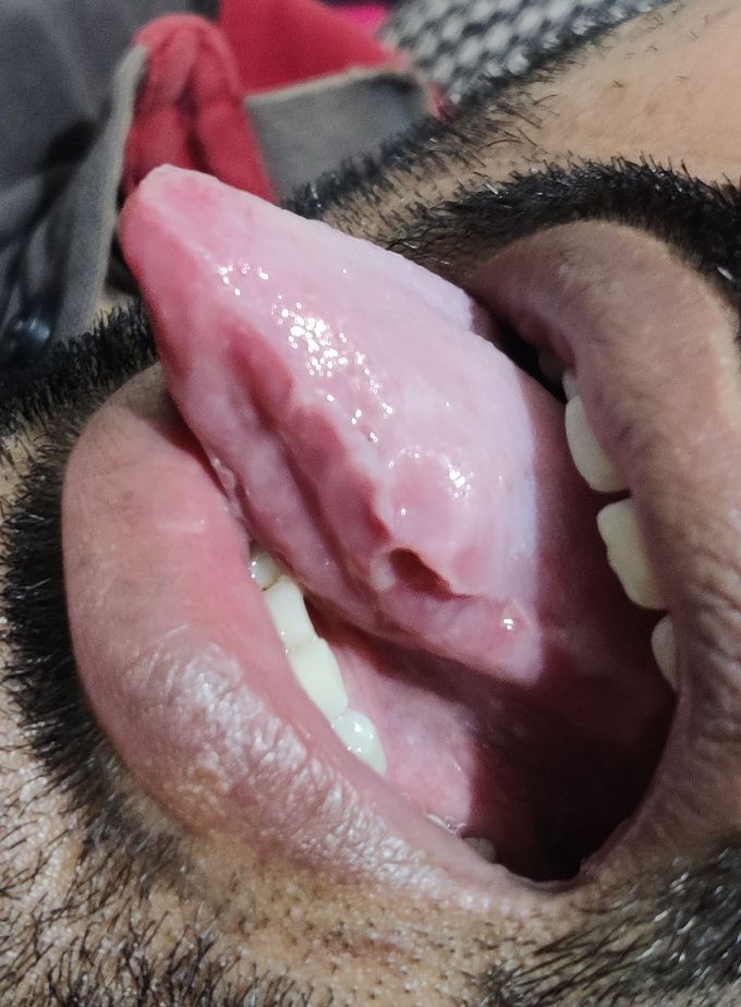 What could be the possible diagnosis?
