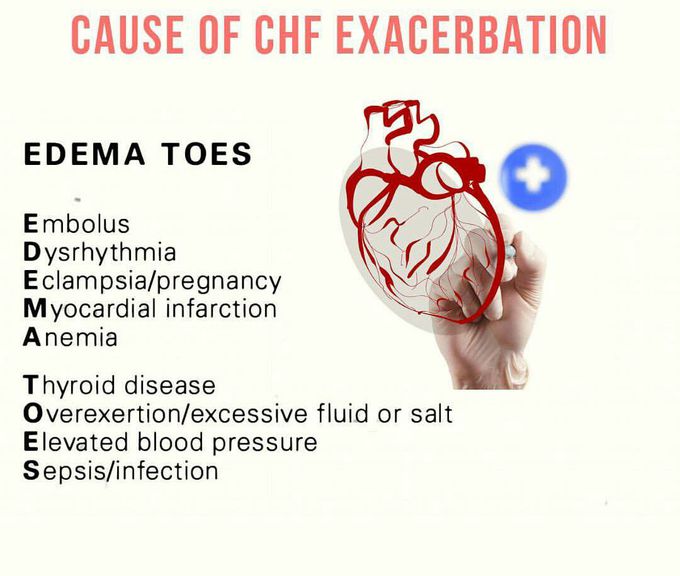 Edema