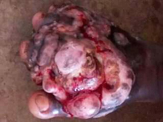 Please diagnosis and treatment