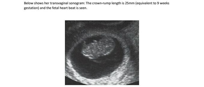 Please interpret this ultrasound