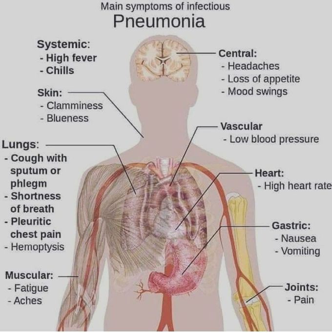 Pneumonia