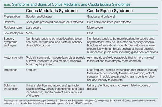 Conus Medullaris vs Cauda Equina Syndrome