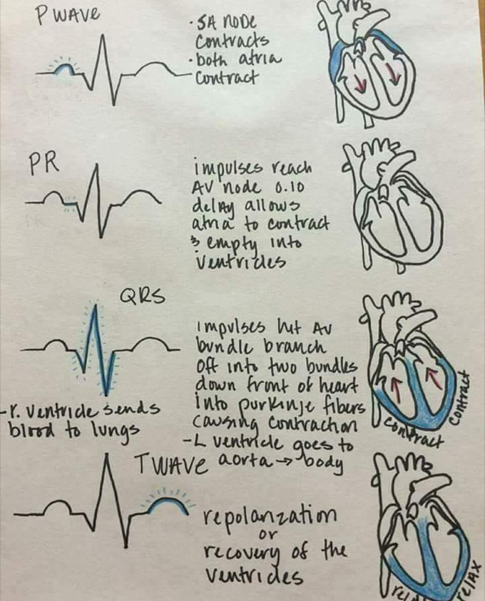 ECG made easy