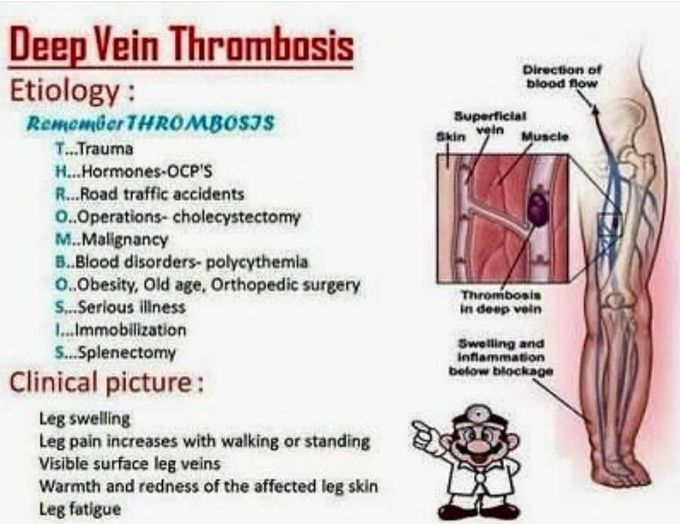 Deep Vein Thrombosis