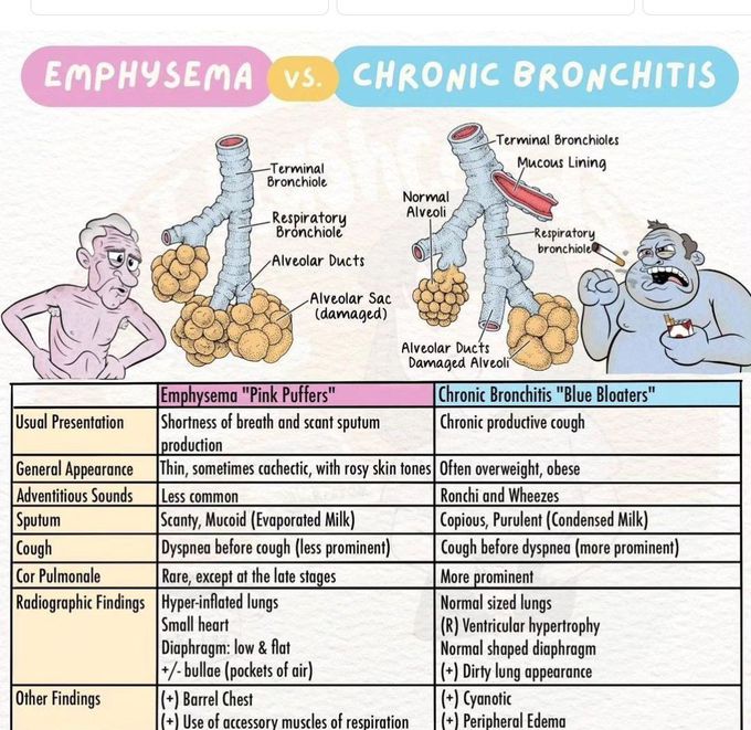 Emphysema Vs Chronic Bronchitis