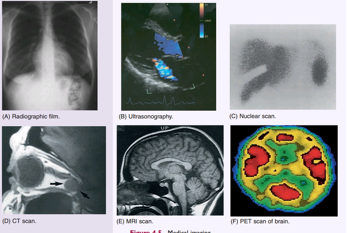 Radiology