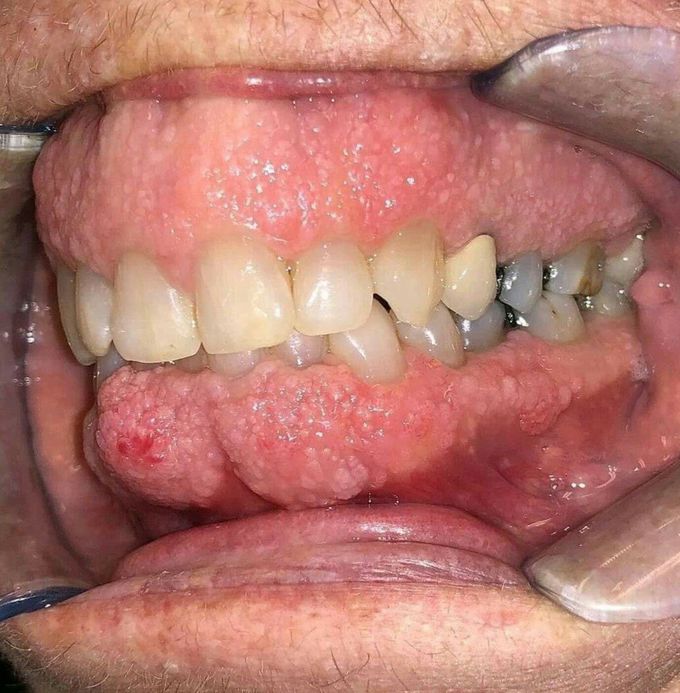 What is diagnosis?