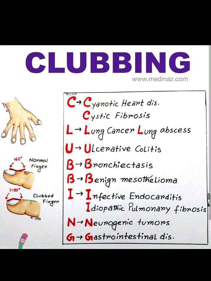 Clubbing