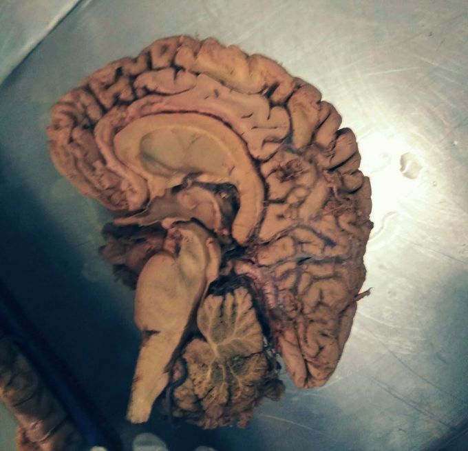 Dissection diaries! :)