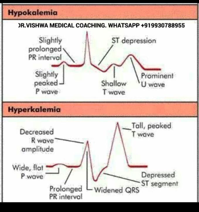 Hypokalemia and hyperkalemia