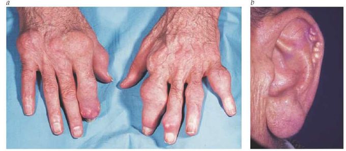 What is the diagnosis?