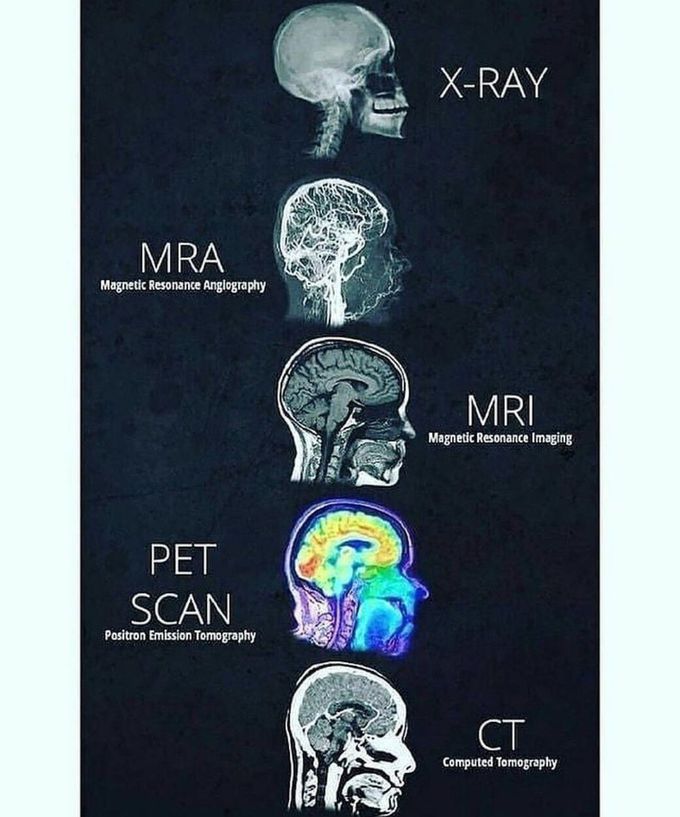 Different methods of radiology imaging!!