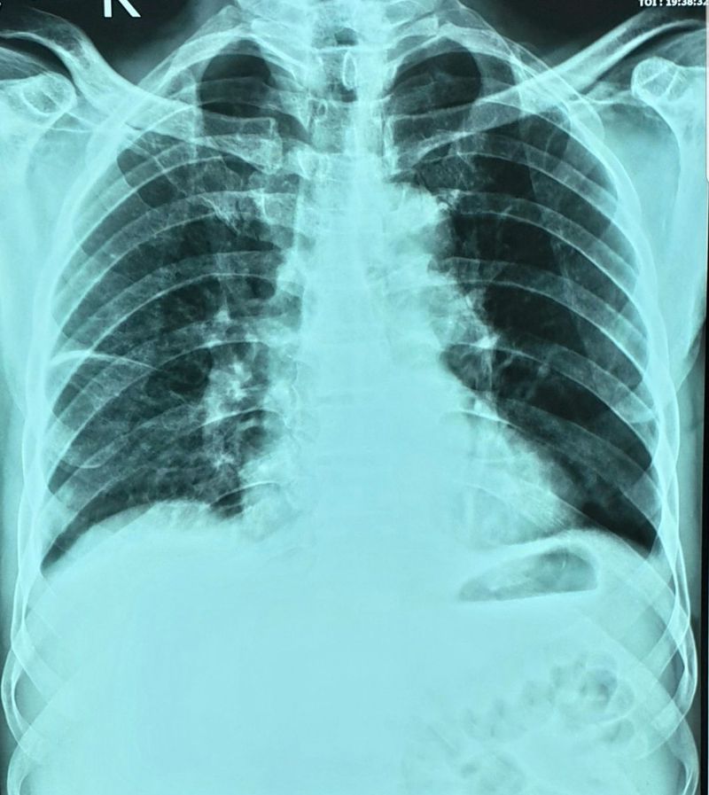 A 65 year old man with fever - MEDizzy