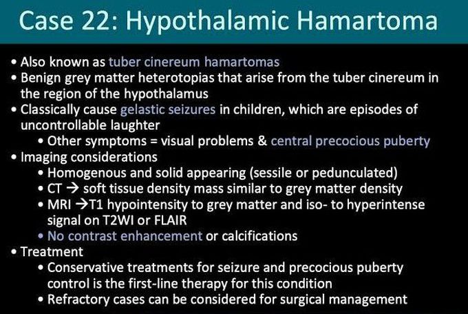 Hypothalamic Hemartoma