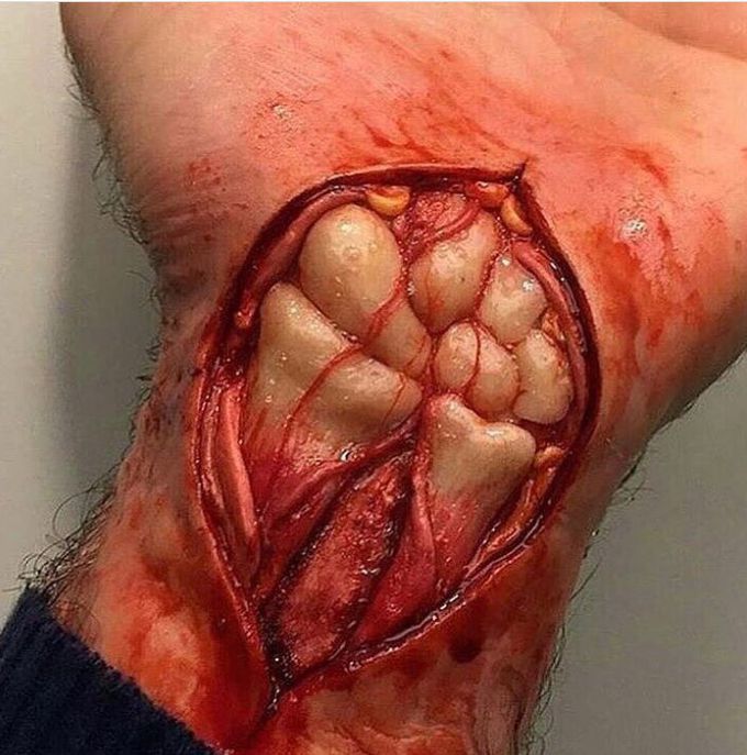 Wrist bones